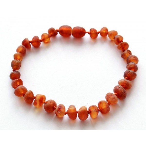 Baroque-Amber-Bracelet